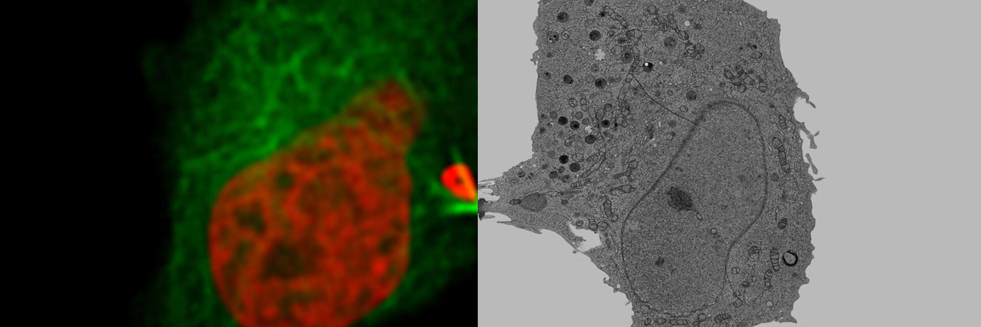 Image collage of a dividing HeLa cell. Left cell shows the fluorescent signals H2B-mCherry and alphaTubulin-mEGFP to visualize microtubules and DNA. The right image shows the corresponding cell, imaged in a transmission electron microscope. 