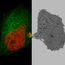 Image collage of a dividing HeLa cell. Left cell shows the fluorescent signals H2B-mCherry and alphaTubulin-mEGFP to visualize microtubules and DNA. The right image shows the corresponding cell, imaged in a transmission electron microscope. 