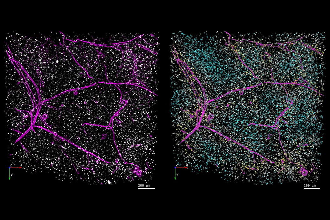 Left-hand image: The distribution of immune cells (white) and blood vessels (pink) in white adipose tissue (image captured using the THUNDER Imager 3D Cell Culture). Right-hand image: The same image after automated analysis using Aivia, with each immune cell color-coded based on its distance to the nearest blood vessel. Image courtesy of Dr. Selina Keppler, Munich, Germany. Fat_tissue_THUNDER_THUNDER-Aivia_teaser.jpg