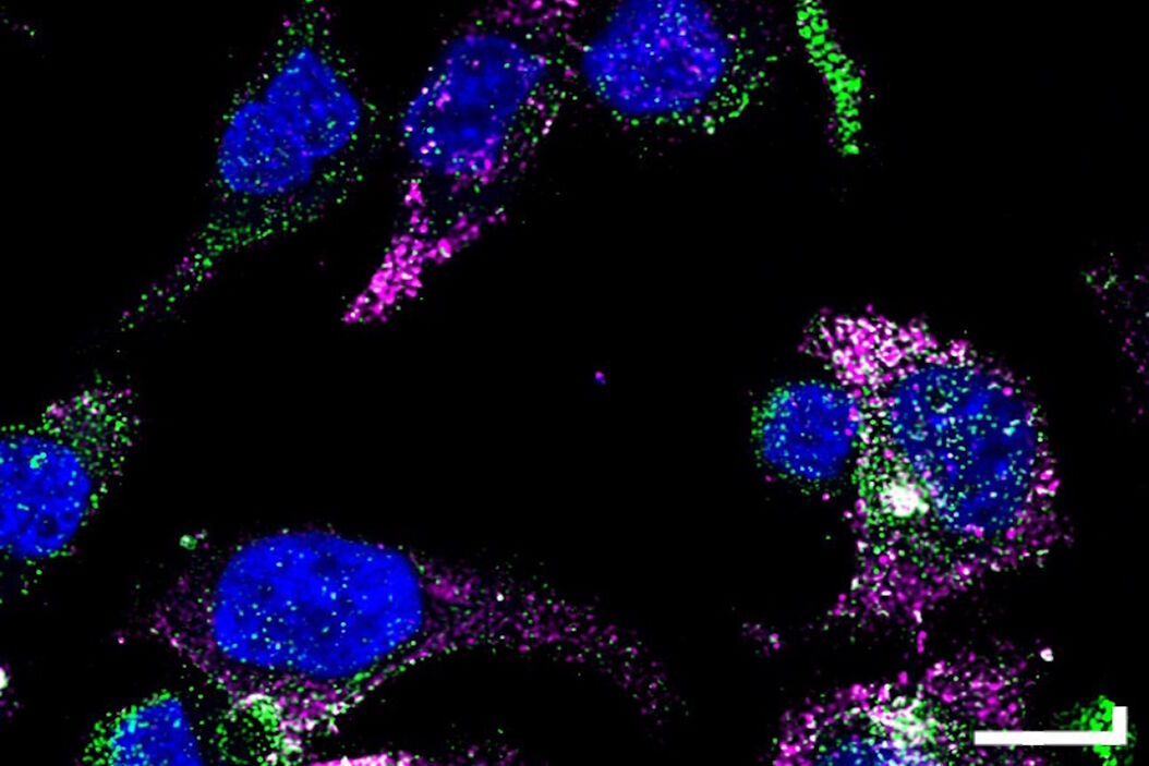 [Translate to chinese:] GLP-1 and PYY localized to distinct secretory pools in L-cells. L-cells.jpg