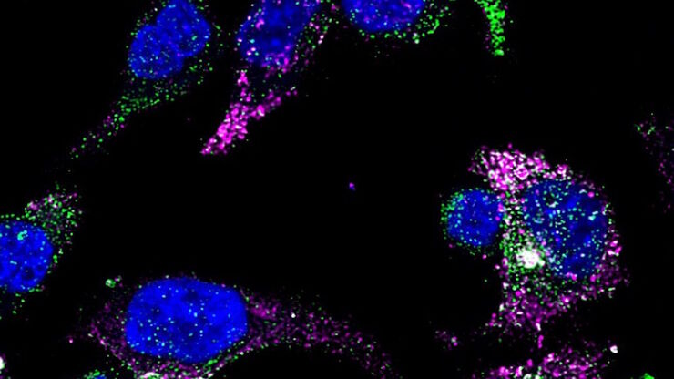 [Translate to chinese:] GLP-1 and PYY localized to distinct secretory pools in L-cells.