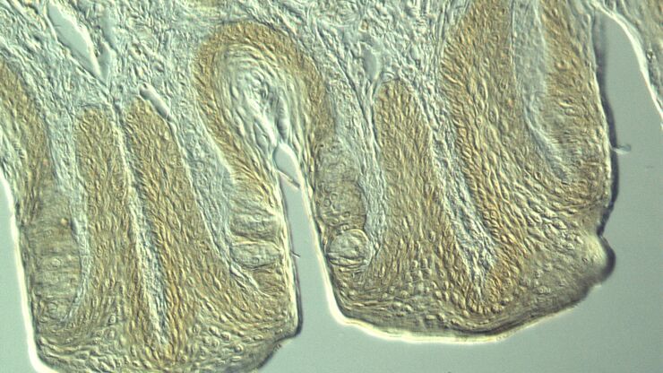 Section taste buds rabbit, differential interference contrast microscope