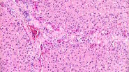 [Translate to chinese:] Brightfield image of a pig liver stained with hematoxylin-eosin (HE).