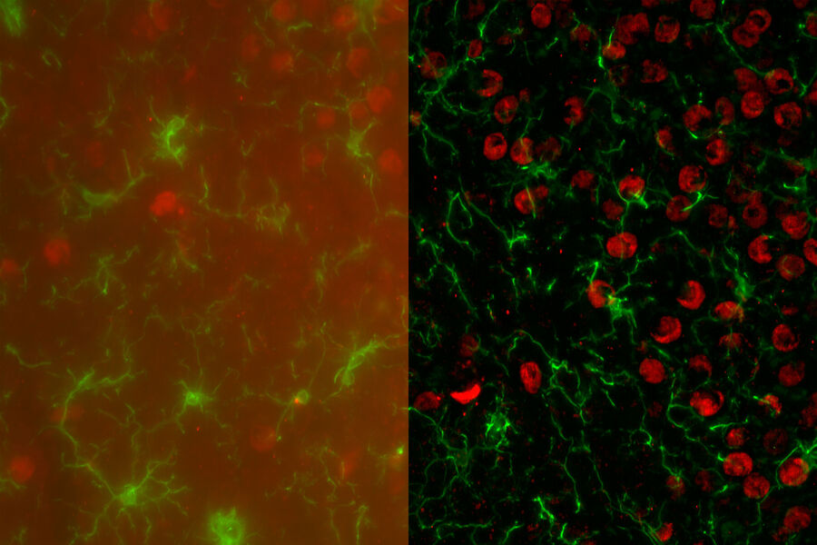 这些图像显示了小鼠大脑中小胶质细胞（IBA-1+，绿色）表达的AMPK（红色）。图像是在THUNDER Imager 3D细胞培养上，使用40x/1.30油物镜拍摄的。两幅图像分别代表了28层平面（总共27微米厚度）的z堆栈的最大强度投影。左侧图像是原始的荧光显微图像，右侧图像是经THUNDER处理的LVCC算法图像。图像由德克萨斯农工大学的Maheedhar Kodali博士提供。