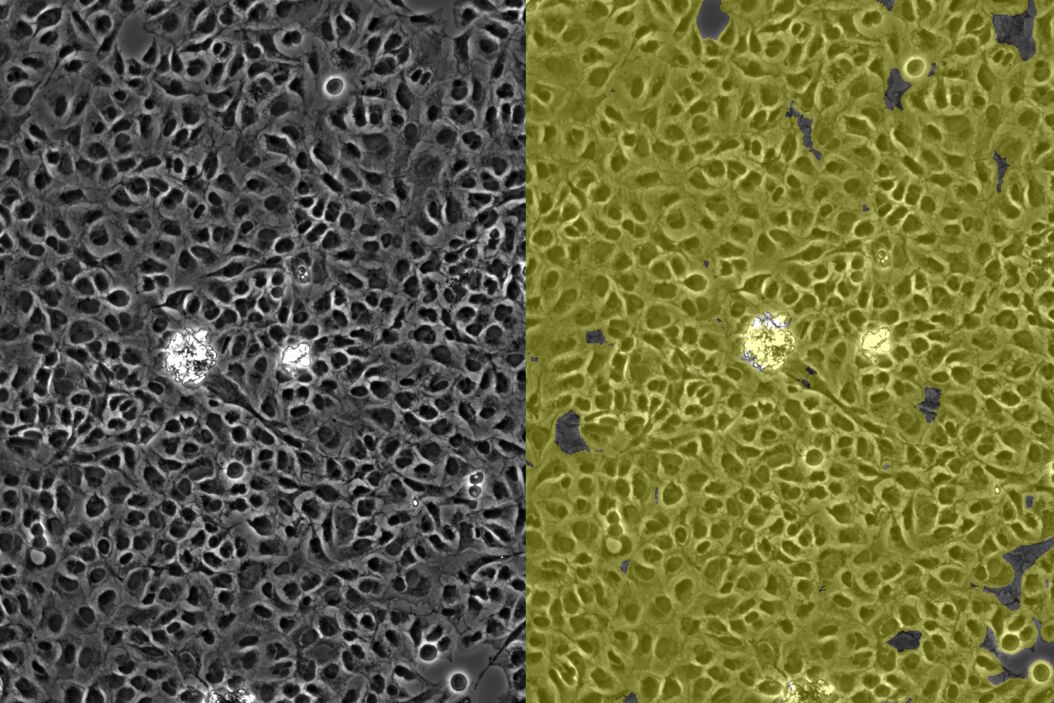 [Translate to chinese:] Image of confluent cells taken with phase contrast (left) and analyzed for confluency using AI (right). Confluent_cells_with_phase_contrast_and_analyzed_for_confluency_using_AI.jpg