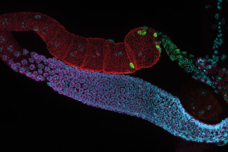 [Translate to chinese:] C. elegans Gonades - THUNDER Imager  Adult hermaphrodit, Staining: blue - DAPI (Nucleus), green - SP56 (sperms), red - RME-2 (oocyte), mangenta - PGL-1 (RNA + protein granules) Image courtesy of Prof. Dr. Christian Eckmann, Martin Luther University, Halle, Germany