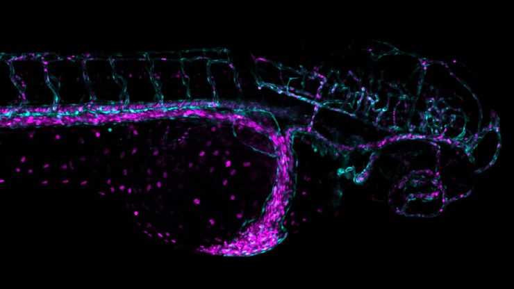 Blood vessel system of a zebrafish larvae.