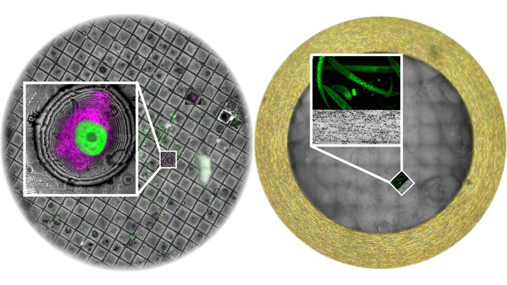 Trichomonas parasite in mouse gut, rOTO Embedding and serial sections for array tomography imaging. Sample courtesy Isabelle Guerin-Bonne, Low Kay En, Electron Microscopy Unit, Yong loo Lin School of Medicine, National University of Singapore