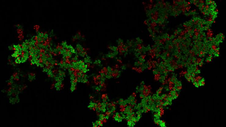 3D culture of ovarian cancer cells imaged using the confocal mode of Mica.