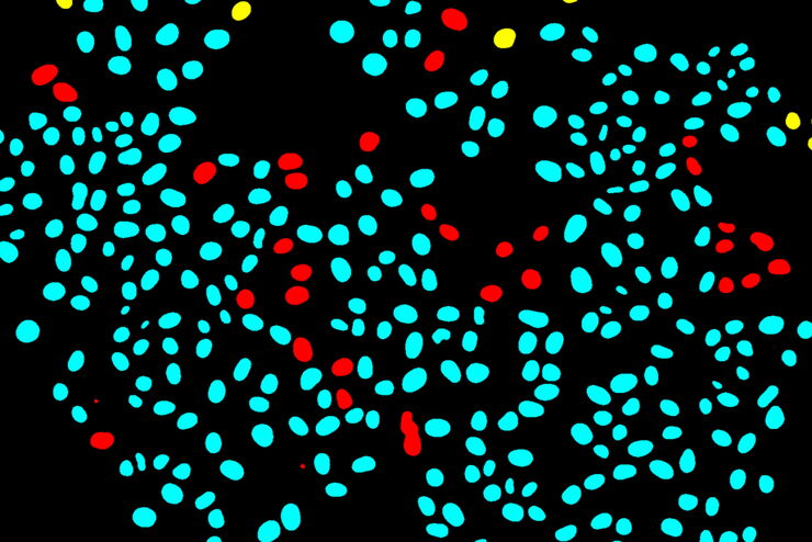 Colourised binary mask of a time-lapse microscopy field of view of medium confluency Separation of cells based on their tracking status: A colourised binary mask of a time-lapse microscopy field of view of medium confluency with individual cells highlighted as survivors if they can be tracked since the initial movie frame (cyan), incomers if they migrated into the field of view throughout the movie (yellow) or mistracks if an error occurred in the automated trajectory reconstruction (red).