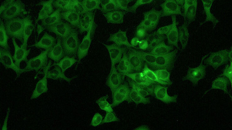 [Translate to chinese:] HeLa Cells 20x Fluorescence