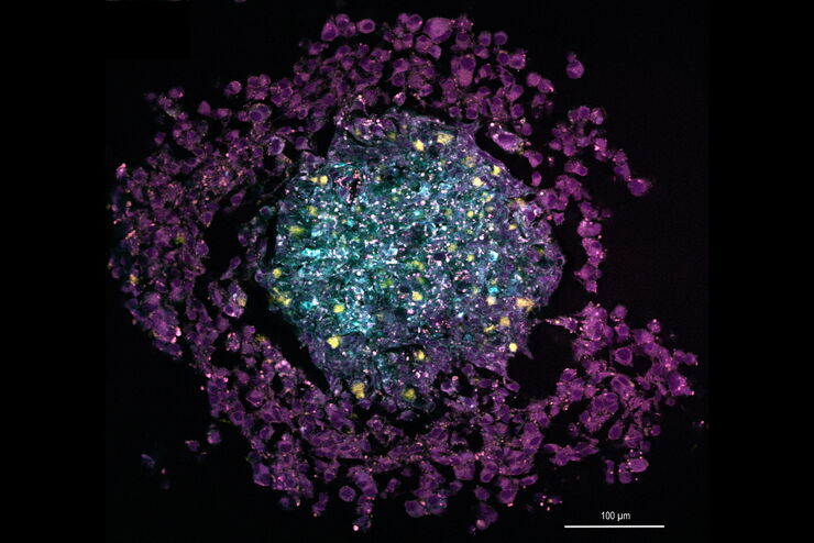 [Translate to chinese:] Multi-color SRS image of a tri-cellular cancer spheroid 