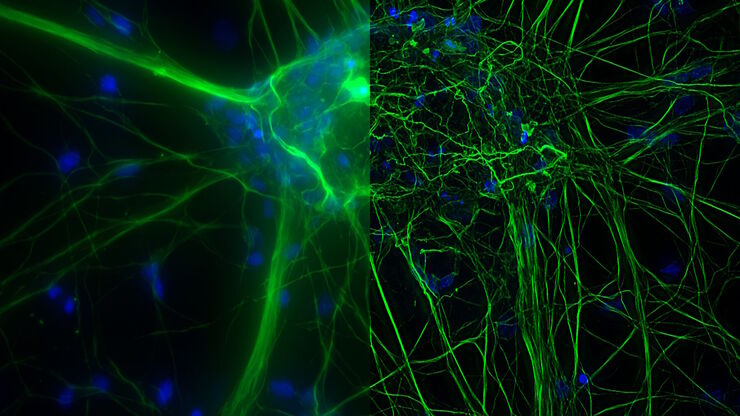 [Translate to chinese:] Microscopy for neuroscience research