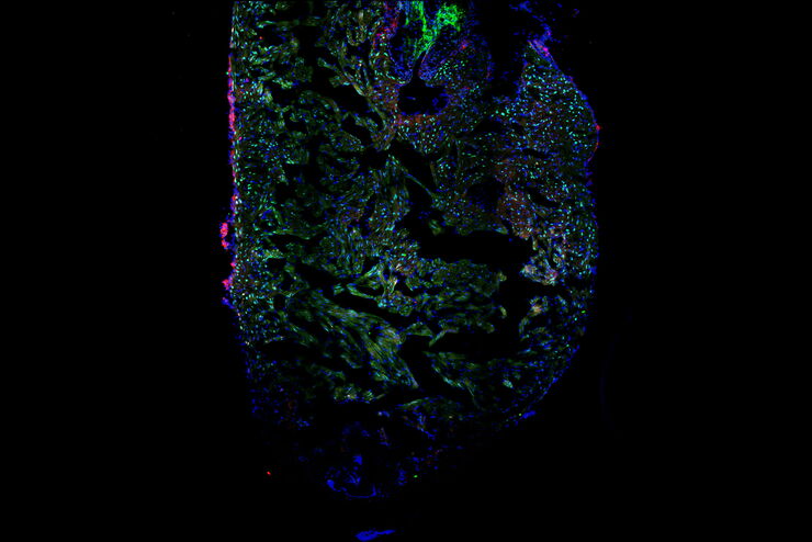 Zebrafish heart showing the ventricle with an injury in the lower area