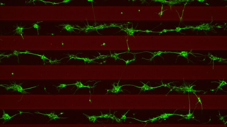 Stripe assay performed on a THUNDER Imager Cell. Courtesy of Maria Carrasquero Ordaz, University of Oxford.