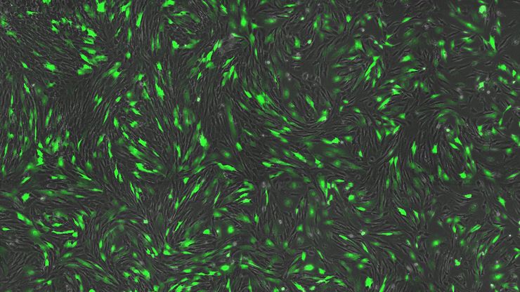 [Translate to chinese:] Transfection using the Uncommon Bio reprogramming system. Image acquired using the THUNDER Imager 3D Cell Culture with THUNDER Large Volume Computational Clearing (LVCC) applied. Image courtesy of Samuel East, Uncommon Bio. 