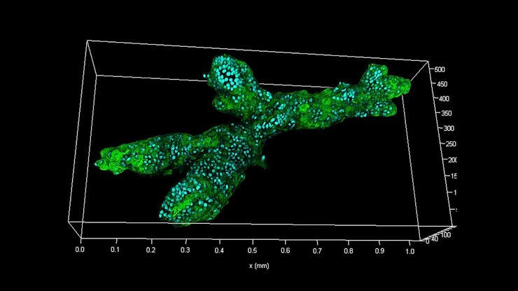 [Translate to chinese:] Branched organoid growing in collagen where the Nuclei are labeled blue. To detect the mechanosignaling process, the YAP1 is labeled green.