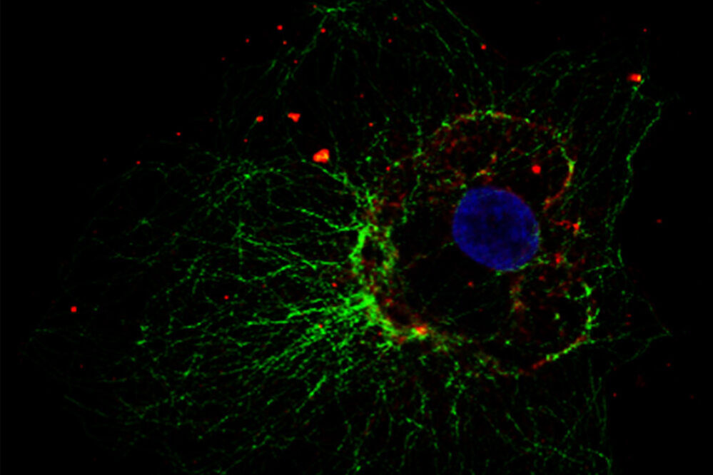 Cellular microtubule network in a fibroblast cell lms-how-to-prepare-specimen-immunofluorescence-microscopy-sl-article-header.jpg