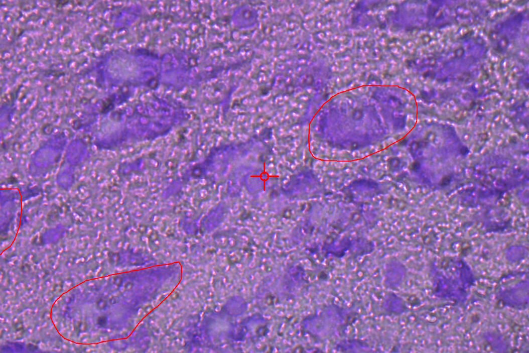 [Translate to chinese:] Image of murine dopaminergic neurons which have been marked for laser microdissection (LMD). Murine_dopaminergic_neurons_marked_for_LMD.jpg