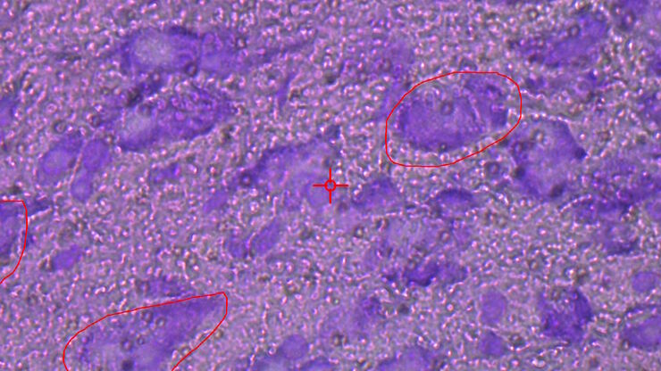 Image of murine dopaminergic neurons which have been marked for laser microdissection (LMD).