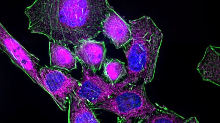 [Translate to chinese:] HeLa cells stimulated with LPS. Image has been subjected to deconvolution.