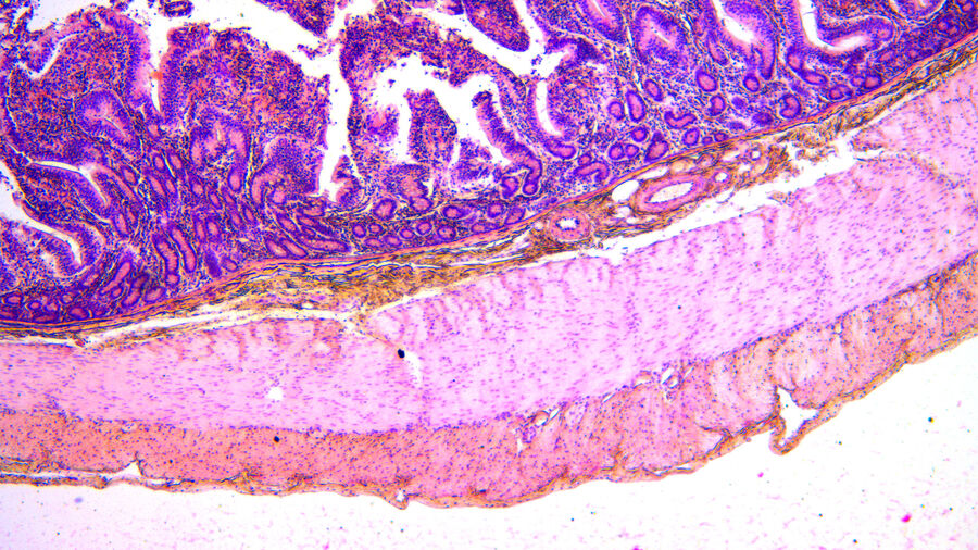 H&E染色的十二指肠图像，显示了黏膜下层和黏膜区域之间的界限，便于区分不同的细胞类型。 