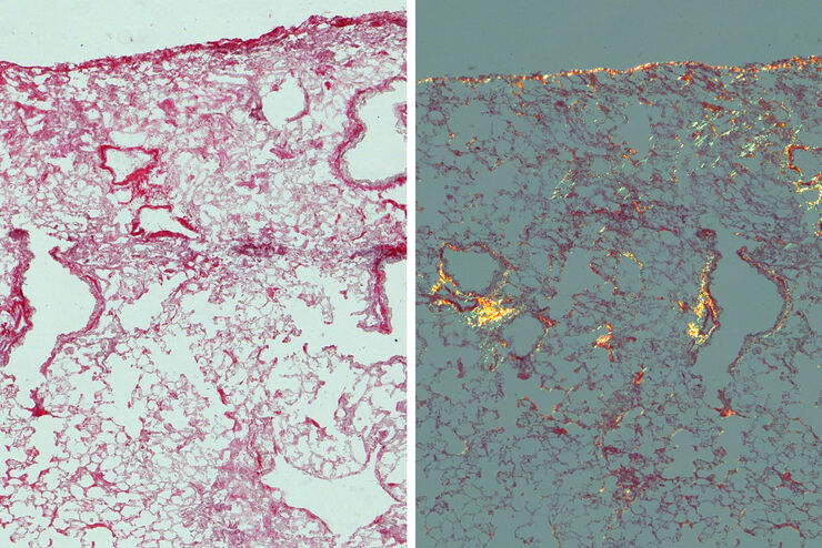 [Translate to chinese:] Mouse lung sections