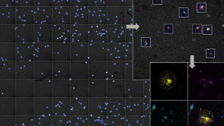 AI-based workflow for fast rare event detection in living biological samples using Autonomous Microscopy powered by Aivia