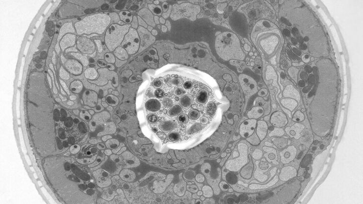 [Translate to chinese:] Structural details of the C. elegans, head in cross-section. Courtesy of Müller-Reichert T, MPI-CBG, Dresden, Germany, and McDonald K, University of California, Berkeley, USA.