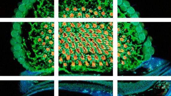 Scheme of a 2D mosaic scan. Drosophila melanogaster (eye section)