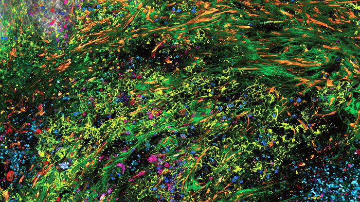 3D high-plex imaging in cancer immunology. Overview of a pancreatic tumor section in mouse model, labeled with 15 markers and imaged in one go using STELLARIS with SpectraPlex. (https://www.nature.com/articles/d42473-024-00260-7) 3D high-plex imaging in cancer immunology. Overview of a pancreatic tumor section in mouse model, labeled with 15 markers and imaged in one go using STELLARIS with SpectraPlex. (https://www.nature.com/articles/d42473-024-00260-7)